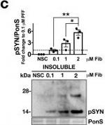 Rabbit IgG (H+L) Secondary Antibody in Western Blot (WB)