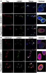 Rabbit IgG (H+L) Cross-Adsorbed Secondary Antibody in Immunocytochemistry (ICC/IF)