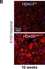 Rabbit IgG (H+L) Cross-Adsorbed Secondary Antibody in Immunocytochemistry (ICC/IF)