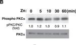 Rabbit IgG (H+L) Secondary Antibody in Western Blot (WB)