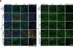 Rabbit IgG (H+L) Highly Cross-Adsorbed Secondary Antibody in Immunohistochemistry (Paraffin) (IHC (P))