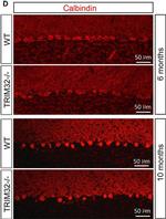 Rabbit IgG (H+L) Highly Cross-Adsorbed Secondary Antibody in Immunohistochemistry (IHC)