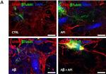 Rabbit IgG (H+L) Cross-Adsorbed Secondary Antibody in Immunocytochemistry (ICC/IF)