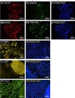 Rabbit IgG (H+L) Highly Cross-Adsorbed Secondary Antibody in Immunocytochemistry (ICC/IF)