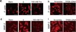 Rabbit IgG (H+L) Highly Cross-Adsorbed Secondary Antibody in Immunocytochemistry (ICC/IF)