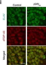 Rabbit IgG (H+L) Highly Cross-Adsorbed Secondary Antibody in Immunocytochemistry (ICC/IF)