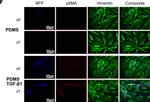 Rabbit IgG (H+L) Cross-Adsorbed Secondary Antibody in Immunocytochemistry (ICC/IF)