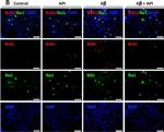 Mouse IgG (H+L) Cross-Adsorbed Secondary Antibody in Immunocytochemistry (ICC/IF)