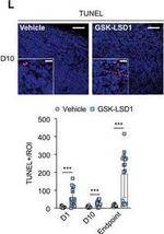 Rabbit IgG (H+L) Cross-Adsorbed Secondary Antibody in Immunohistochemistry (IHC)