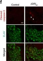 Rabbit IgG (H+L) Highly Cross-Adsorbed Secondary Antibody in Immunocytochemistry (ICC/IF)