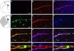 Goat IgG (H+L) Cross-Adsorbed Secondary Antibody in Immunohistochemistry (Paraffin) (IHC (P))