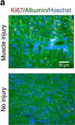 Mouse IgG (H+L) Highly Cross-Adsorbed Secondary Antibody in Immunohistochemistry (Frozen) (IHC (F))