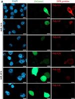 Rat IgG (H+L) Cross-Adsorbed Secondary Antibody in Immunocytochemistry (ICC/IF)