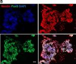 Rabbit IgG (H+L) Cross-Adsorbed Secondary Antibody in Immunocytochemistry (ICC/IF)