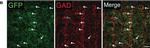 Chicken IgY (H+L) Secondary Antibody in Immunohistochemistry (IHC)