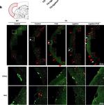 Rabbit IgG (H+L) Highly Cross-Adsorbed Secondary Antibody in Immunohistochemistry (Paraffin) (IHC (P))