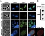 Rabbit IgG (H+L) Cross-Adsorbed Secondary Antibody in Immunocytochemistry (ICC/IF)