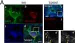 Mouse IgG (H+L) Cross-Adsorbed Secondary Antibody in Immunocytochemistry (ICC/IF)