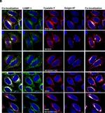 Mouse IgG (H+L) Highly Cross-Adsorbed Secondary Antibody in Immunocytochemistry (ICC/IF)