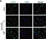 Mouse IgG (H+L) Highly Cross-Adsorbed Secondary Antibody in Immunocytochemistry (ICC/IF)