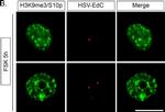 Rabbit IgG (H+L) Cross-Adsorbed Secondary Antibody in Immunohistochemistry (IHC)