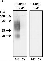 Rabbit IgG (H+L) Secondary Antibody in Western Blot (WB)