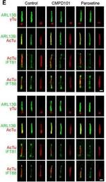 Mouse IgG (H+L) Highly Cross-Adsorbed Secondary Antibody in Immunohistochemistry (IHC)