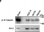 Rat IgG (H+L) Secondary Antibody in Western Blot (WB)