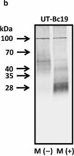 Rabbit IgG (H+L) Secondary Antibody in Western Blot (WB)