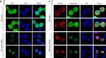 Mouse IgG (H+L) Cross-Adsorbed Secondary Antibody in Immunocytochemistry (ICC/IF)