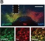 Rabbit IgG (H+L) Cross-Adsorbed Secondary Antibody in Immunohistochemistry (IHC)