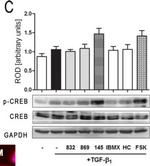 Rabbit IgG (H+L) Secondary Antibody in Western Blot (WB)