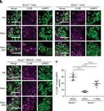 Rat IgG (H+L) Cross-Adsorbed Secondary Antibody in Immunocytochemistry (ICC/IF)