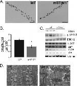 STIM1 Antibody in Western Blot (WB)