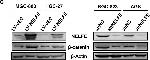 Rabbit IgG (H+L) Secondary Antibody in Western Blot (WB)