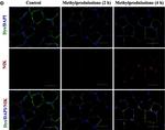 Rabbit IgG (H+L) Highly Cross-Adsorbed Secondary Antibody in Immunohistochemistry (IHC)