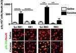 Mouse IgG (H+L) Cross-Adsorbed Secondary Antibody in Immunohistochemistry (IHC)