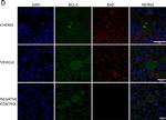 Rabbit IgG (H+L) Cross-Adsorbed Secondary Antibody in Immunohistochemistry (Paraffin) (IHC (P))