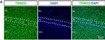 Rabbit IgG (H+L) Highly Cross-Adsorbed Secondary Antibody in Immunohistochemistry (IHC)