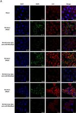 Rabbit IgG (H+L) Secondary Antibody in Immunocytochemistry (ICC/IF)