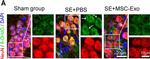 Mouse IgG (H+L) Highly Cross-Adsorbed Secondary Antibody in Immunohistochemistry (IHC)