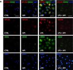 Rabbit IgG (H+L) Cross-Adsorbed Secondary Antibody in Immunocytochemistry (ICC/IF)