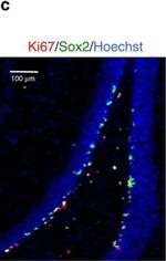 Rabbit IgG (H+L) Cross-Adsorbed Secondary Antibody in Immunohistochemistry (IHC)