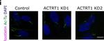 Mouse IgG (H+L) Cross-Adsorbed Secondary Antibody in Immunocytochemistry (ICC/IF)