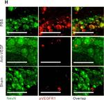 Rabbit IgG (H+L) Highly Cross-Adsorbed Secondary Antibody in Immunohistochemistry (Paraffin) (IHC (P))