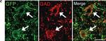 Chicken IgY (H+L) Secondary Antibody in Immunohistochemistry (IHC)