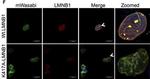 Rabbit IgG (H+L) Cross-Adsorbed Secondary Antibody in Immunohistochemistry (IHC)