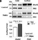 Rabbit IgG (H+L) Secondary Antibody in Western Blot (WB)