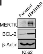 Goat IgG (H+L) Secondary Antibody in Western Blot (WB)