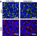 Mouse IgG (H+L) Cross-Adsorbed Secondary Antibody in Immunocytochemistry (ICC/IF)